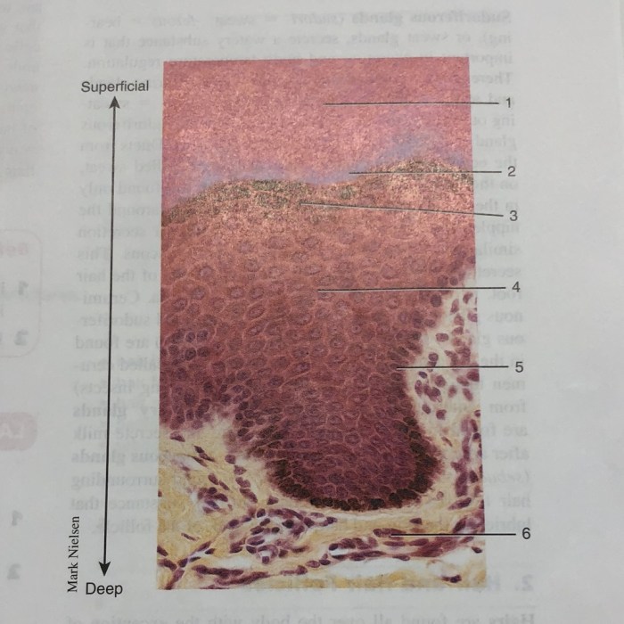 Thick skin epidermis stratum corneum under thin anatomy dermis lucidum layer basale granulosum spinosum cells superficial