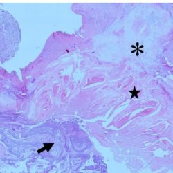 Label the photomicrograph of thick skin.