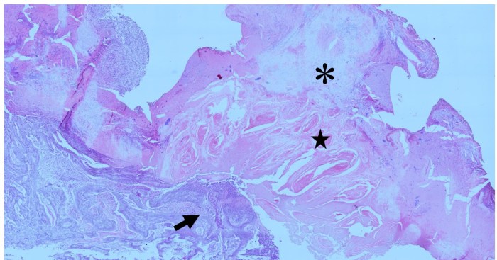 Label the photomicrograph of thick skin.