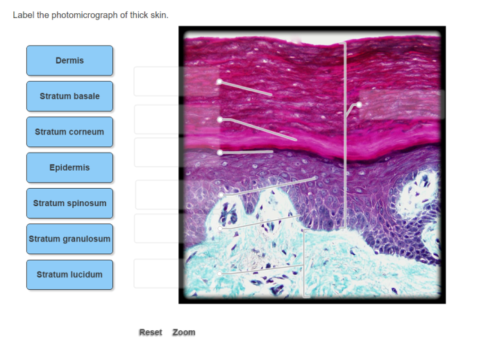 Label the photomicrograph of thick skin.