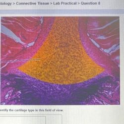 Pal histology muscular tissue lab practical question 15