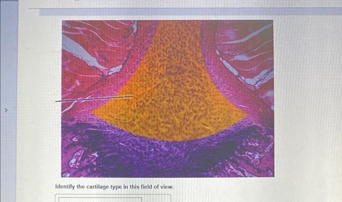 Pal histology muscular tissue lab practical question 15