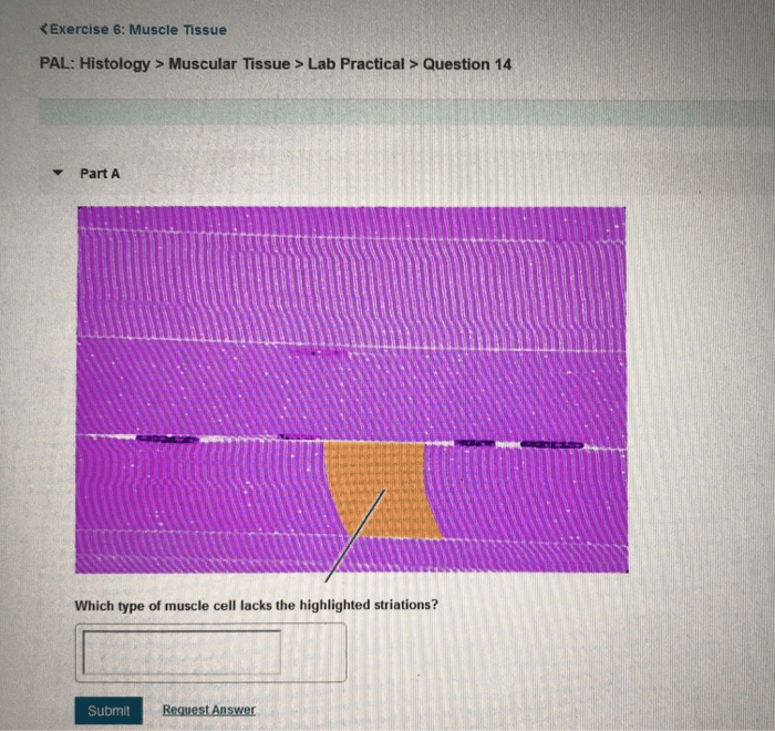 Pal histology muscular tissue lab practical question 15